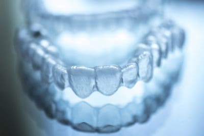 top 3 surprising benefits of invisalign